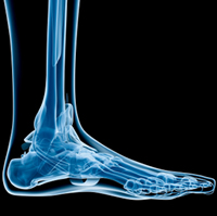 Common foot and ankle disorders